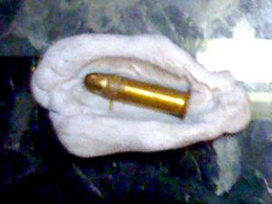 A picture of the bullet