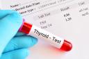A thyroid function blood test. June 1 was World Hypopara Awareness Day. Picture Thinkstock/PA