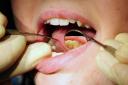 Thousands of children in Yorkshire and the Humber were admitted to hospital with rotten teeth, data shows