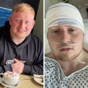 Brave Cain North, 22, from York has been given one year to live after being diagnosed with a brain tumour and is dedicating that time to helping others