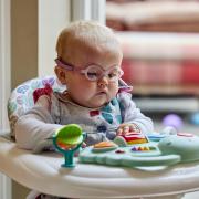One-year-old Margot from York was born without eyes