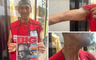 York’s most well-known Big Issue vendor Vasile Calin says he was left cut and bruised after being attacked in broad daylight